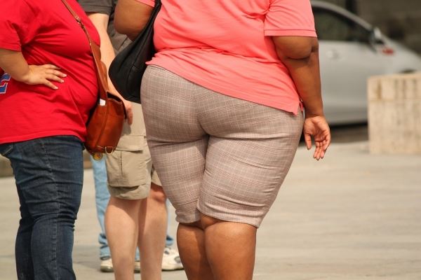 Роспотребнадзор: ожирение сокращает жизнь на срок до 15 лет